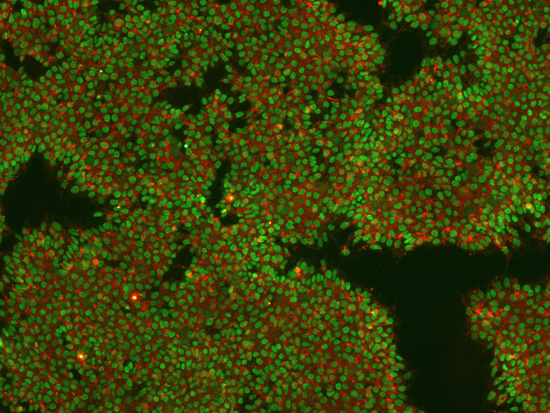 Image of an IPSC Culture Stained for Markers Nanog and TRA160