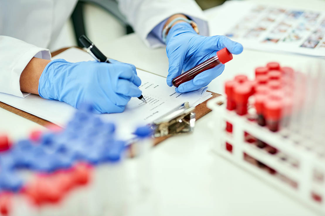 Close up of blood samples in tubes and racks with lab record writing Close up of blood samples in tubes and racks with lab record writing
