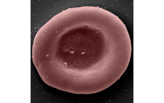 Final batch of red blood cells produced in RESTORE 