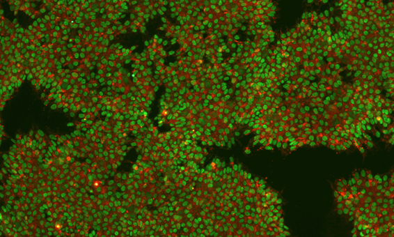 Image of an IPSC Culture Stained for Markers Nanog and TRA160
