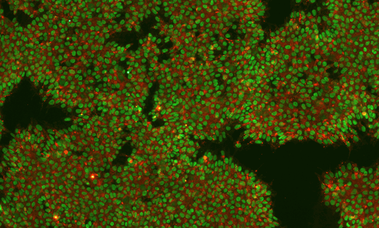 Image of an IPSC Culture Stained for Markers Nanog and TRA160